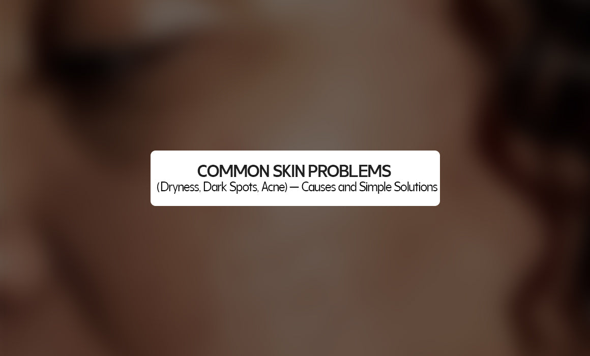 Common Skin Problems (Dryness, Dark Spots, Acne) — Causes and Simple Solutions